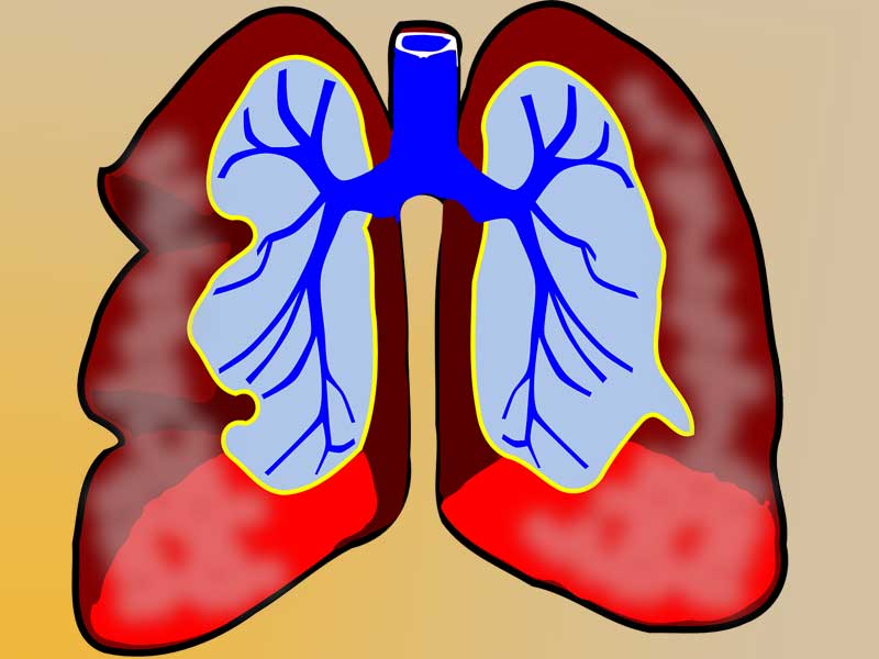A Critical Window In Early Life for Microbiome and Asthma